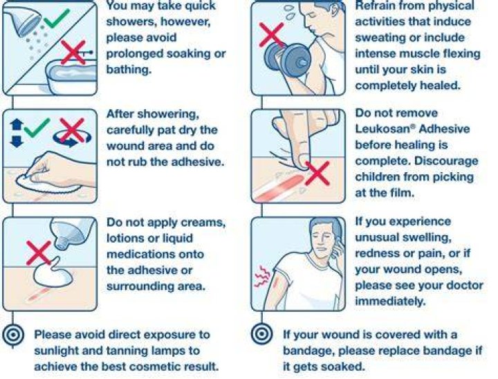 How do you glue a wound shut?