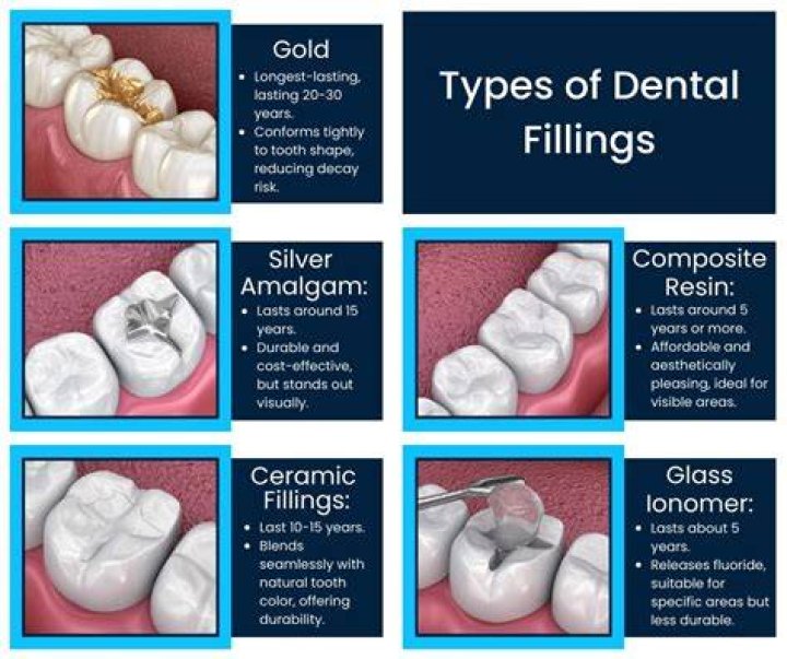 What were fillings made of in the 50s?